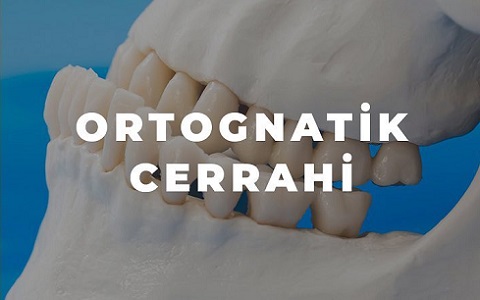 Ortognatik Tedavi
